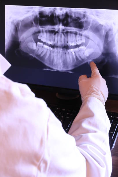 Best Broken or Chipped Tooth Repair in Downey, CA